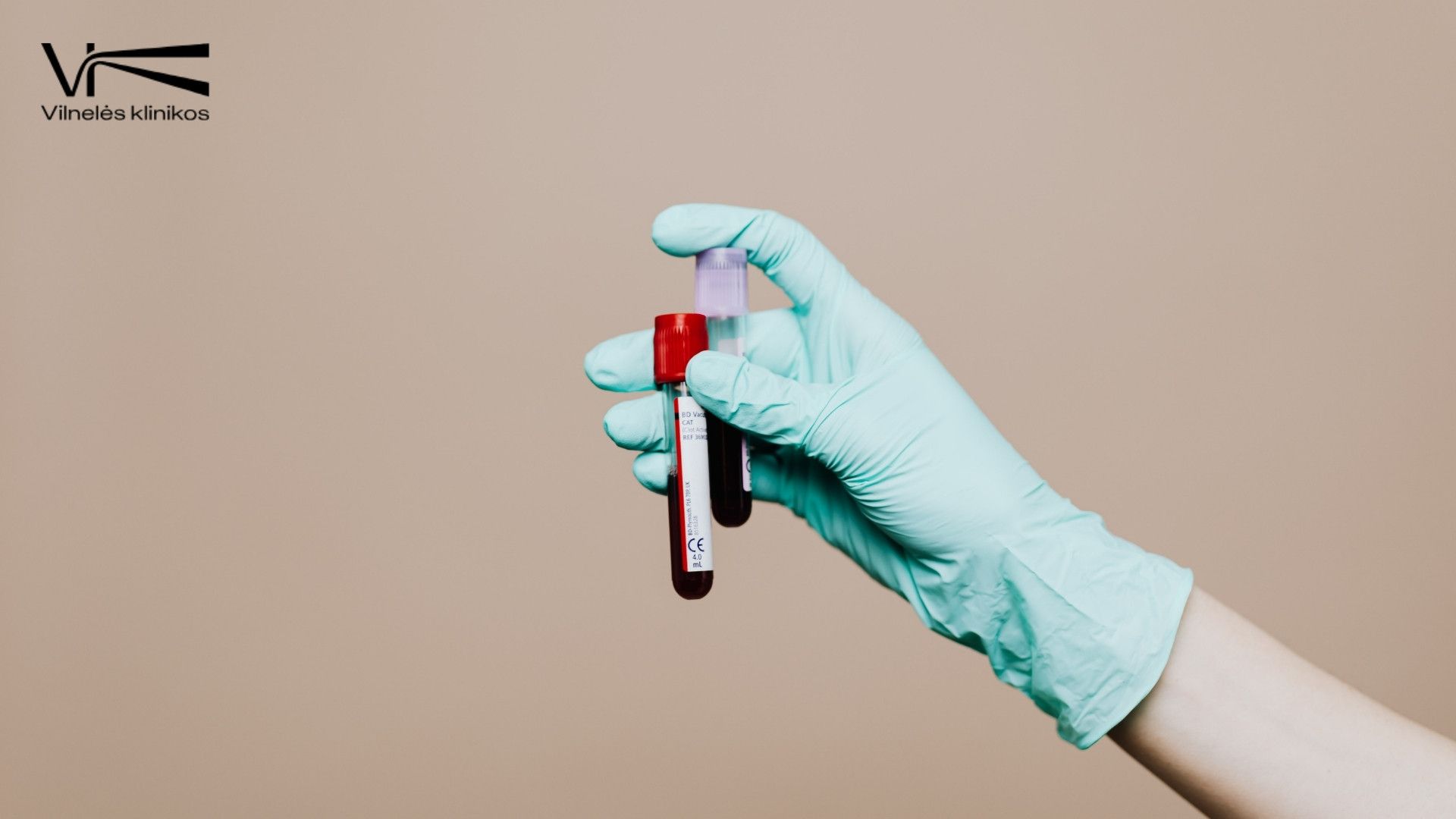 Laboratoriniai tyrimai sportuojantiems: kurie rodikliai padeda stebėti organizmo būklę?